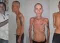 Political prisoners: Political prisoner Alexander Díaz Rodríguez released with severe malnutrition