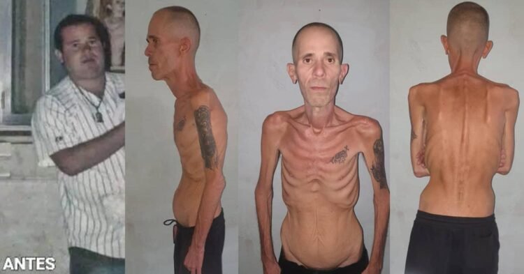 Political prisoners: Political prisoner Alexander Díaz Rodríguez released with severe malnutrition