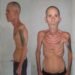 Political prisoners: Political prisoner Alexander Díaz Rodríguez released with severe malnutrition