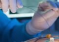 They propose audit and evaluation of angioplasty cases