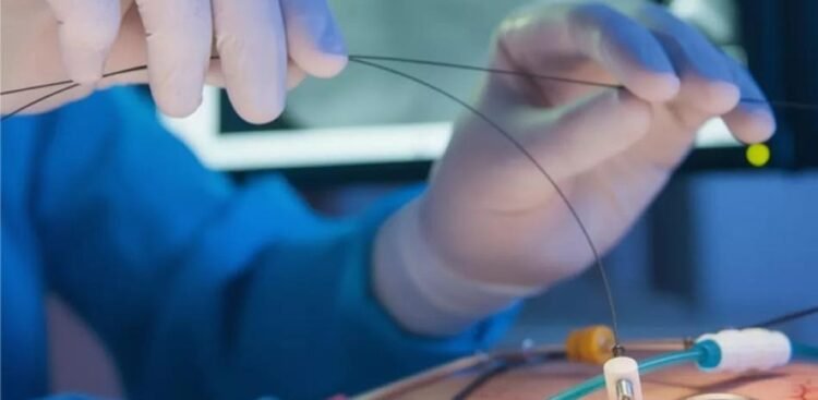 They propose audit and evaluation of angioplasty cases