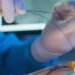 They propose audit and evaluation of angioplasty cases