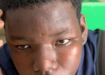 Mother seeks justice for son brutally beaten in school | News