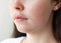 Female facial hair: causes and effective methods of removal