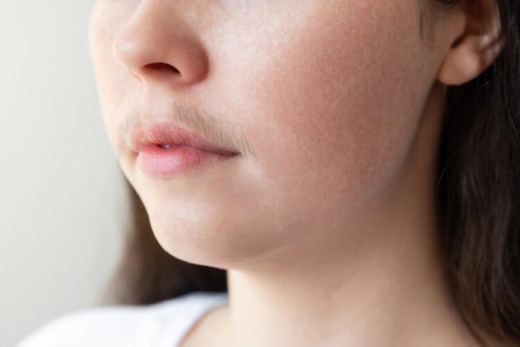 Female facial hair: causes and effective methods of removal