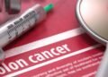 Surgery often the first step in colorectal cancer treatment | Health