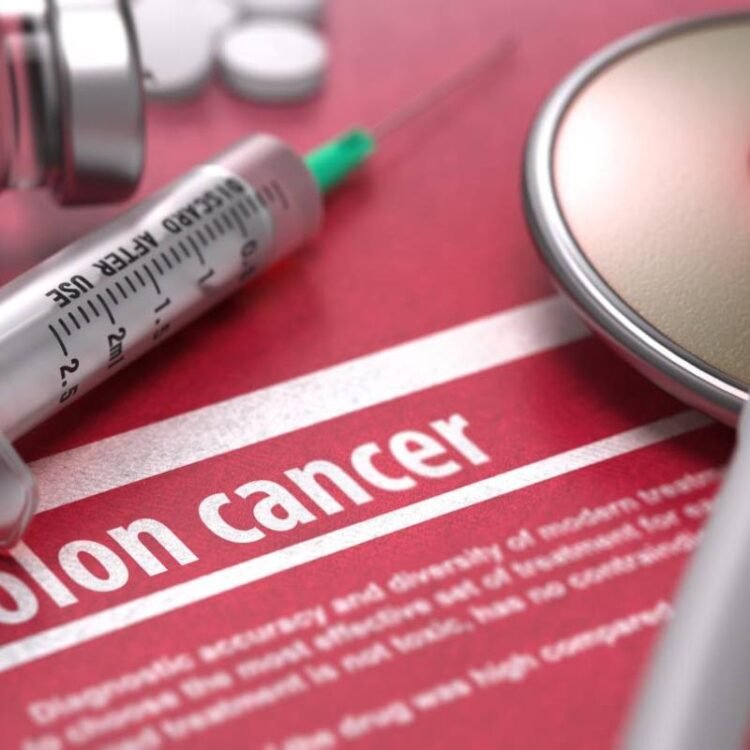 Surgery often the first step in colorectal cancer treatment | Health