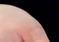 Tiny device with life-saving impact | Health
