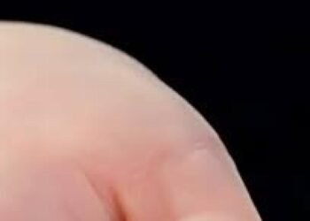 Tiny device with life-saving impact | Health