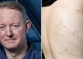 Fight against lice: “Somewhere they are multiplying”