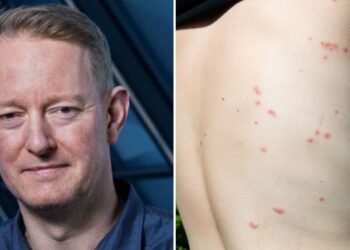 Fight against lice: “Somewhere they are multiplying”