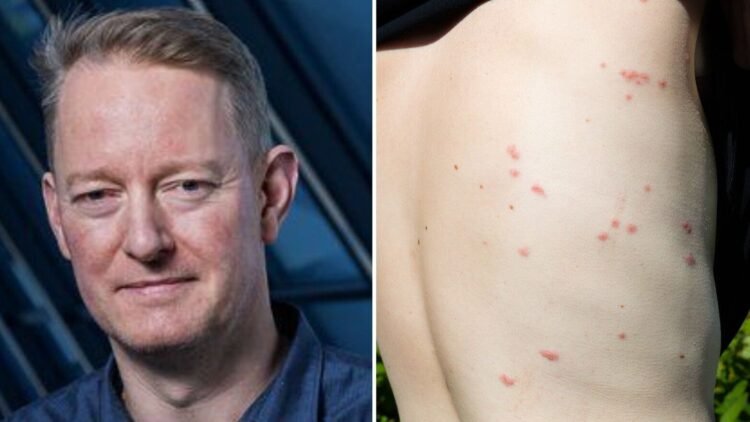 Fight against lice: “Somewhere they are multiplying”