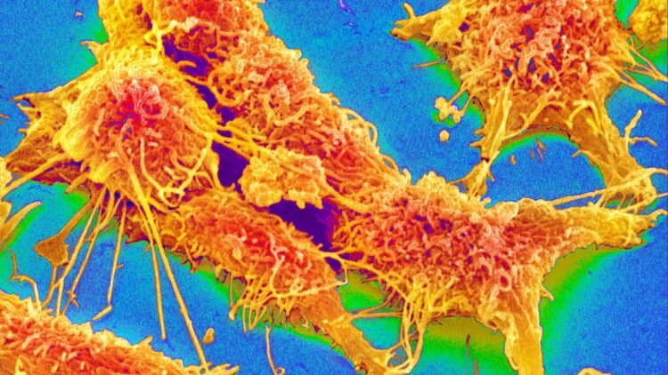 Colon cancer: You shouldn’t ignore these symptoms