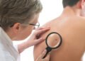 Fewer lung and colon cancer cases, skin and prostate cancers up