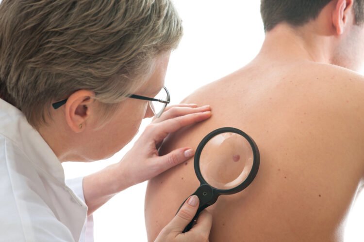 Fewer lung and colon cancer cases, skin and prostate cancers up