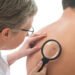Fewer lung and colon cancer cases, skin and prostate cancers up