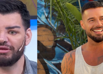Man had surgery more than 30 times to look like Ricky Martin, but it went wrong: he claims that his doctor injected him with motorcycle oil | DNA Diary