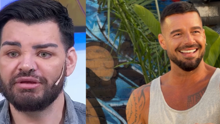Man had surgery more than 30 times to look like Ricky Martin, but it went wrong: he claims that his doctor injected him with motorcycle oil | DNA Diary
