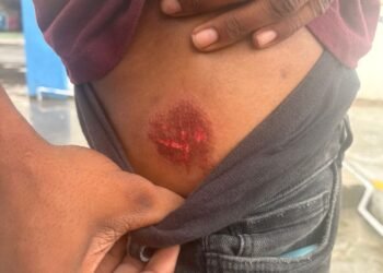 Bandits escape as police open fire on innocent teens