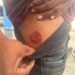 Bandits escape as police open fire on innocent teens