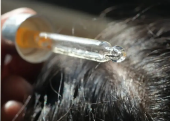 Hair growth products sold on Amazon are recalled over poisoning risk