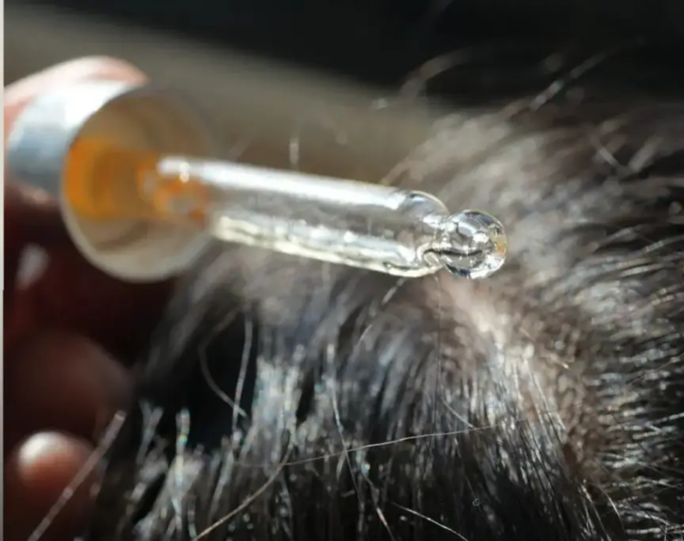 Hair growth products sold on Amazon are recalled over poisoning risk