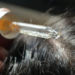Hair growth products sold on Amazon are recalled over poisoning risk