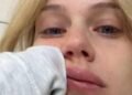 Bar Sommer shares tears: “I got shingles. I’ve been going through a period that doesn’t end since birth”