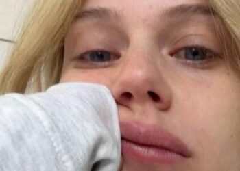 Bar Sommer shares tears: “I got shingles. I’ve been going through a period that doesn’t end since birth”