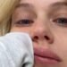 Bar Sommer shares tears: “I got shingles. I’ve been going through a period that doesn’t end since birth”
