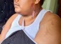 Survivor from new Demerara Bridge accident still in pain, discomfort