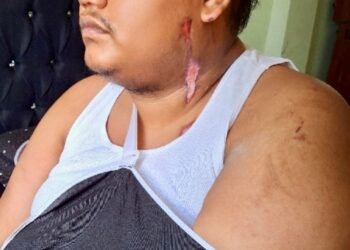 Survivor from new Demerara Bridge accident still in pain, discomfort
