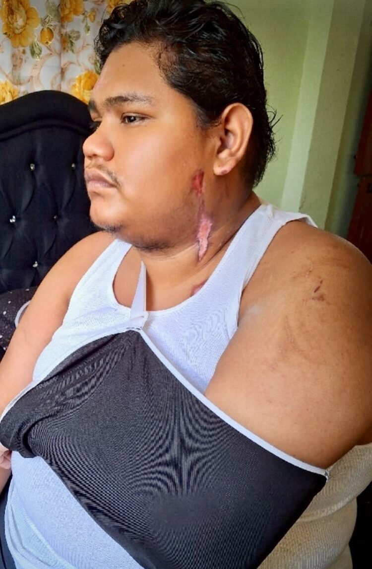 Survivor from new Demerara Bridge accident still in pain, discomfort