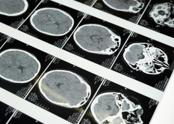 Following deadly UK outbreak: Protecting yourself against meningitis in Luxembourg