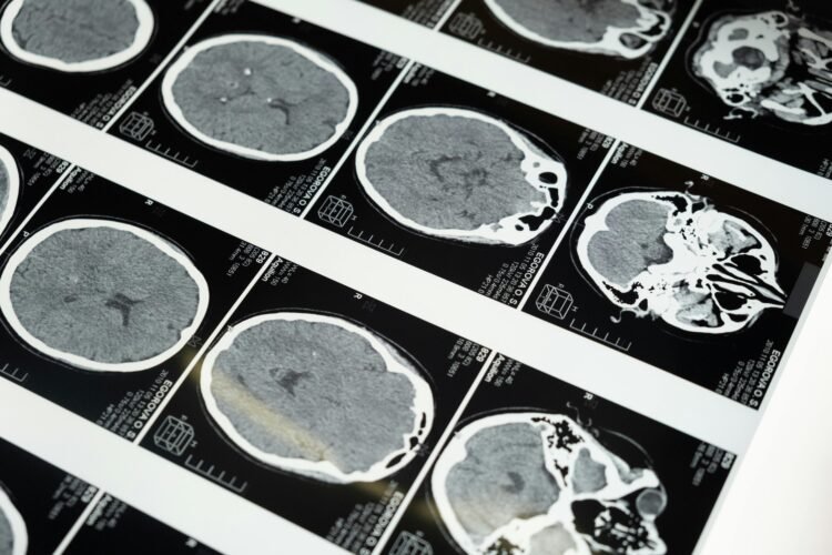 Following deadly UK outbreak: Protecting yourself against meningitis in Luxembourg