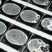 Following deadly UK outbreak: Protecting yourself against meningitis in Luxembourg