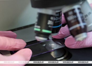 Expert: Belarus ranks among world leaders in early-stage cervical cancer detection
