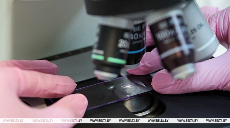 Expert: Belarus ranks among world leaders in early-stage cervical cancer detection