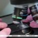 Expert: Belarus ranks among world leaders in early-stage cervical cancer detection