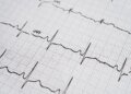 The physical pressure exerted by the heartbeat could explain why the heart is ‘shielded’ against cancer