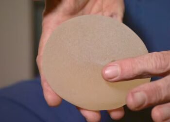 Advocates slam Health Canada’s new voluntary breast implant registry, MP ‘deeply disappointed’