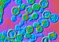 Hantavirus in Argentina: cases have doubled since June 2025