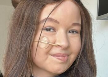 Influencer Jade Kops dies at 19 after battling cancer