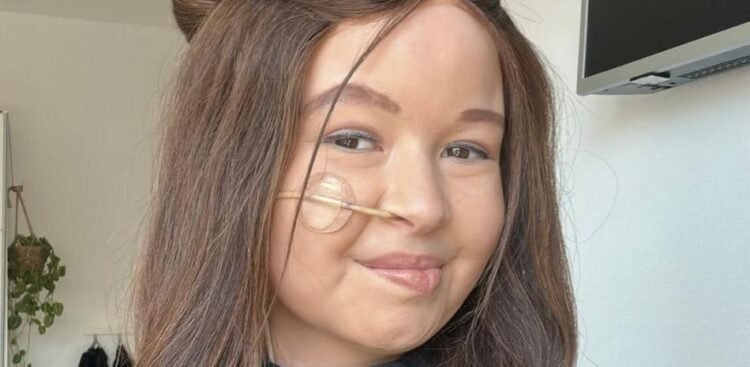 Influencer Jade Kops dies at 19 after battling cancer