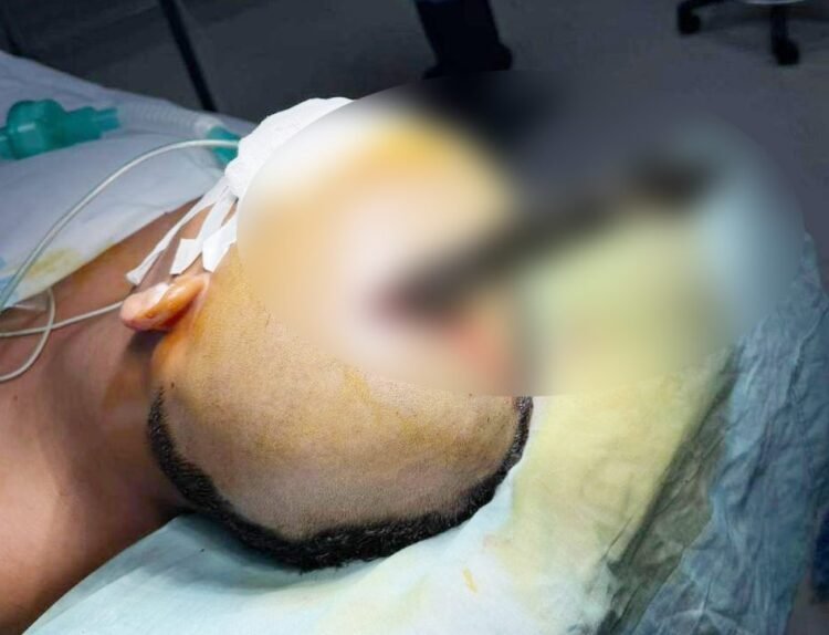 Knife removed from teen’s brain