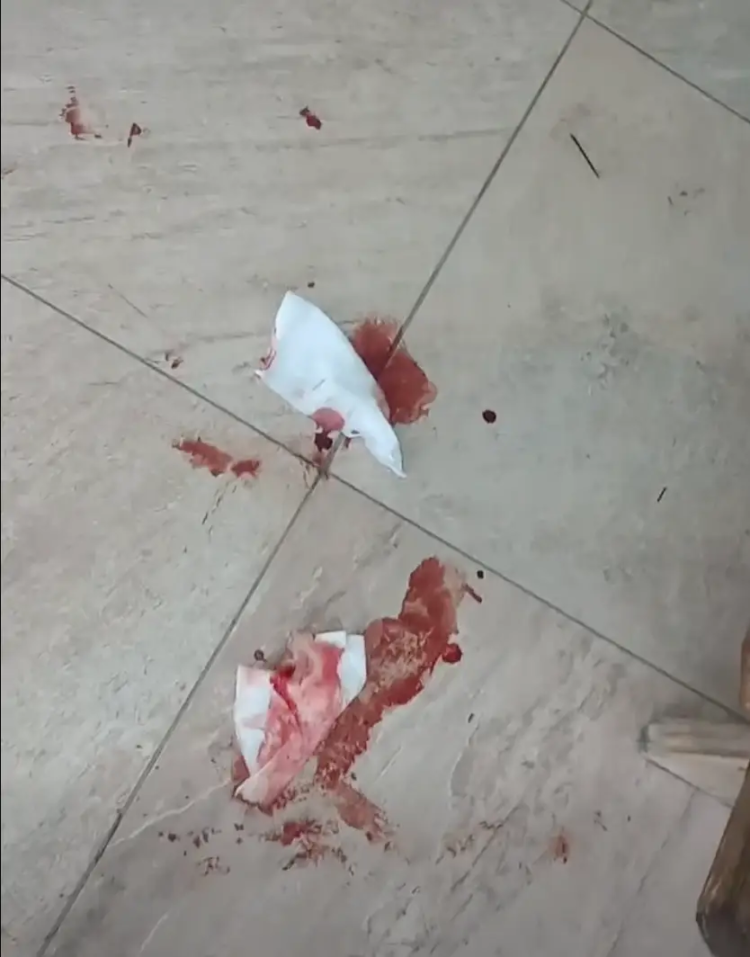 VIDEO: Man Discovers Mysterious Trail of Blood Outside Public Library