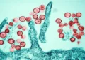 Hanta virus: what the WHO says after deaths on board a ship