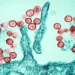 Hanta virus: what the WHO says after deaths on board a ship