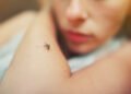 The deadly disease returns with travelers: 10 cases of malaria were recorded in Lithuania last year