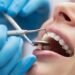 Oral care safety: The Ministry of Health prepares a national guide – Today Morocco